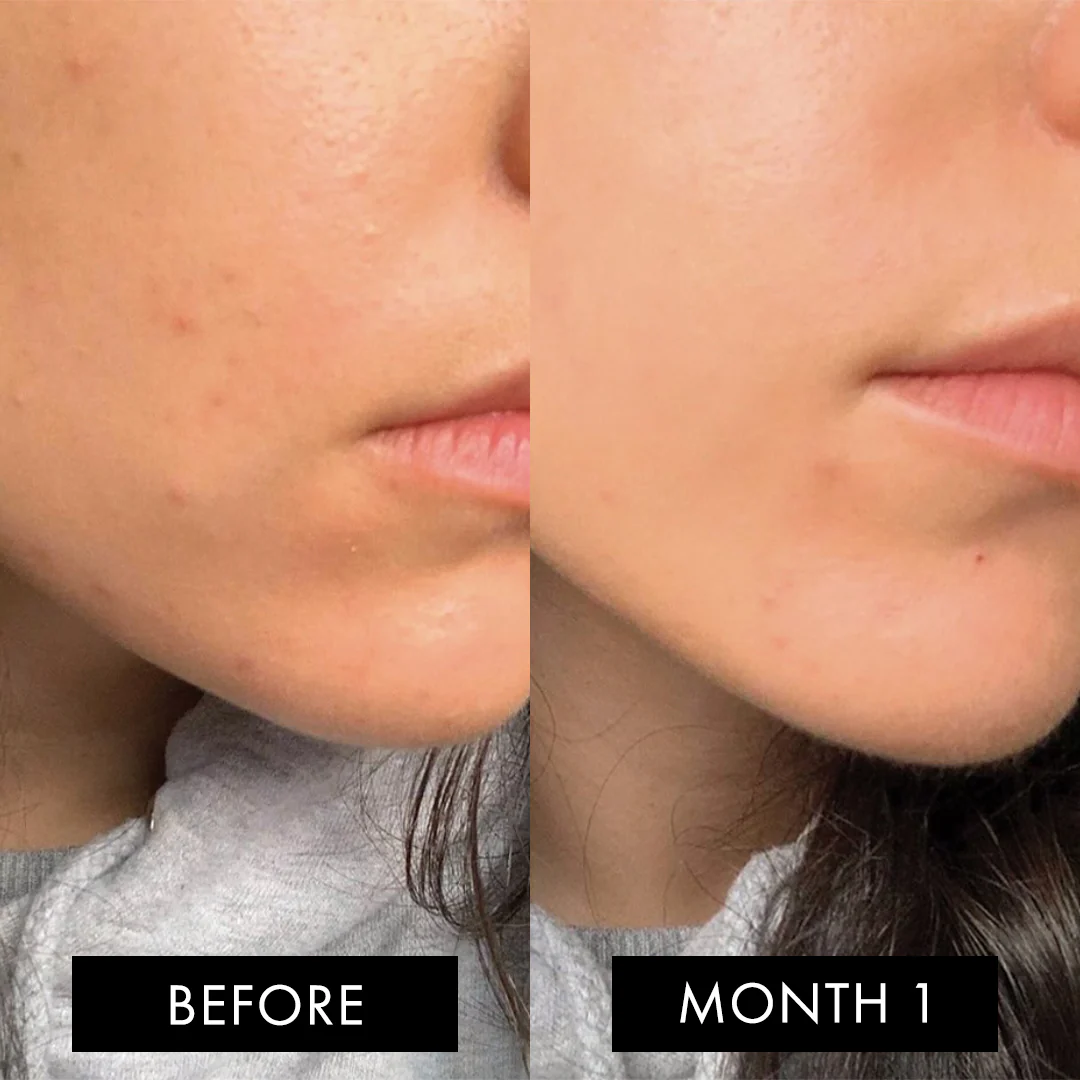 The Skin Elixir® Three Month Pack - Image 10