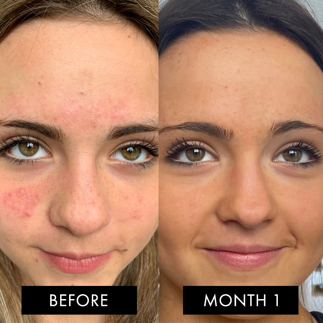 The Skin Elixir® Three Month Pack - Image 9